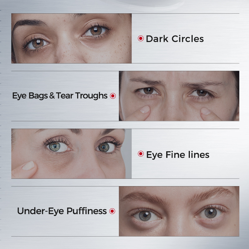 Патчи для глаз от темных круго – обзор и цена Eye Pad Collagen