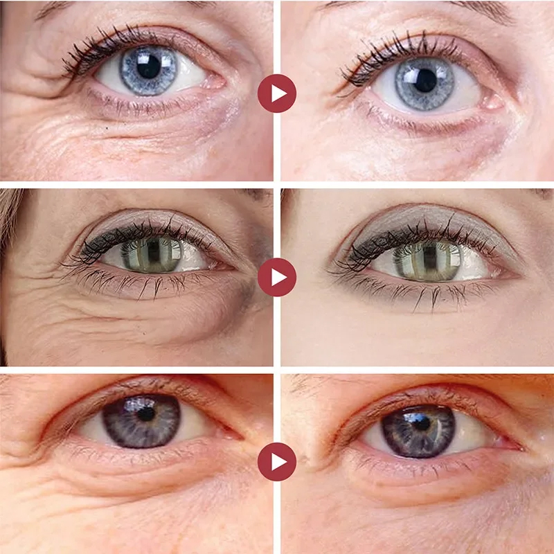 Удаление морщин, патчи для гла – обзор и цена Eye Pad Collagen